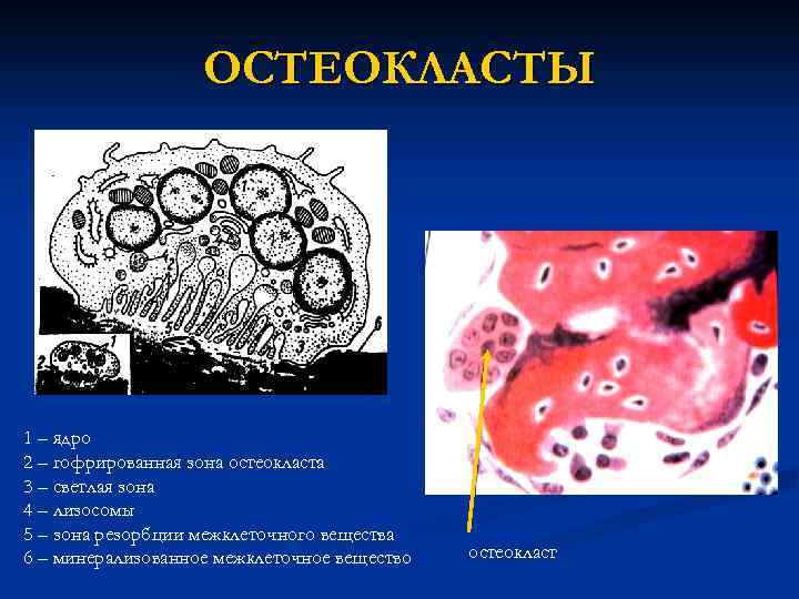 ОСТЕОКЛАСТЫ 1 – ядро 2 – гофрированная зона остеокласта 3 – светлая зона 4