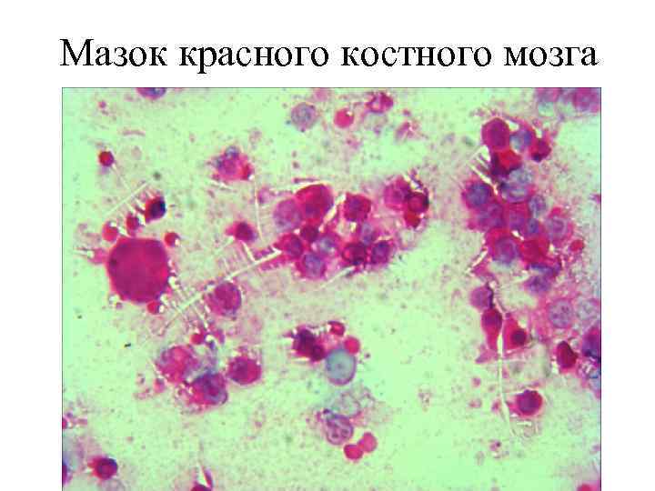 Мазок красного костного мозга 