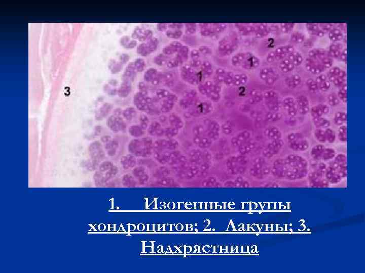 1. Изогенные групы хондроцитов; 2. Лакуны; 3. Надхрястница 