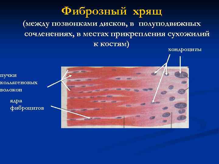 Фиброзный хрящ (между позвонками дисков, в полуподвижных сочленениях, в местах прикрепления сухожилий к костям)