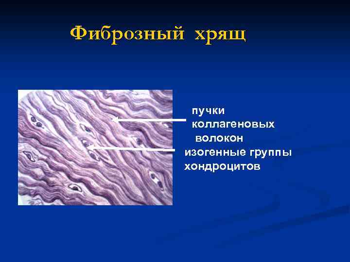 Фиброзный хрящ пучки коллагеновых волокон изогенные группы хондроцитов 