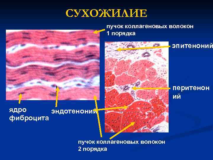 СУХОЖИЛИЕ пучок коллагеновых волокон 1 порядка эпитеноний перитенон ий ядро эндотеноний фиброцита пучок коллагеновых