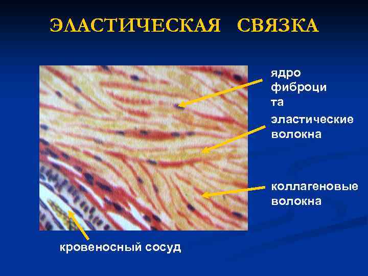 ЭЛАСТИЧЕСКАЯ СВЯЗКА ядро фиброци та эластические волокна коллагеновые волокна кровеносный сосуд 