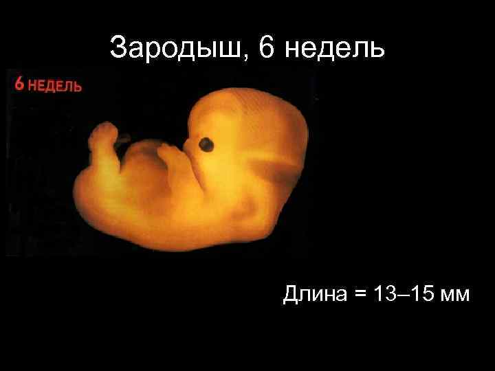 Зародыш, 6 недель Длина = 13– 15 мм 