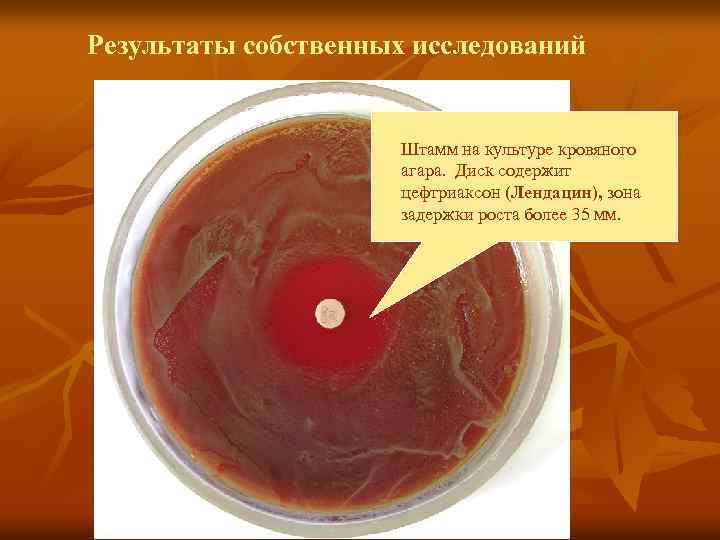 Результаты собственных исследований Штамм на культуре кровяного агара. Диск содержит цефтриаксон (Лендацин), зона задержки