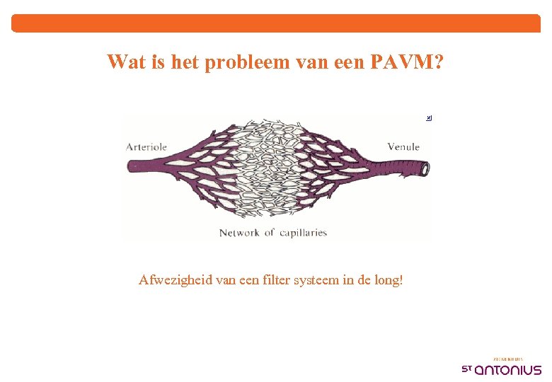Wat is het probleem van een PAVM? Afwezigheid van een filter systeem in de