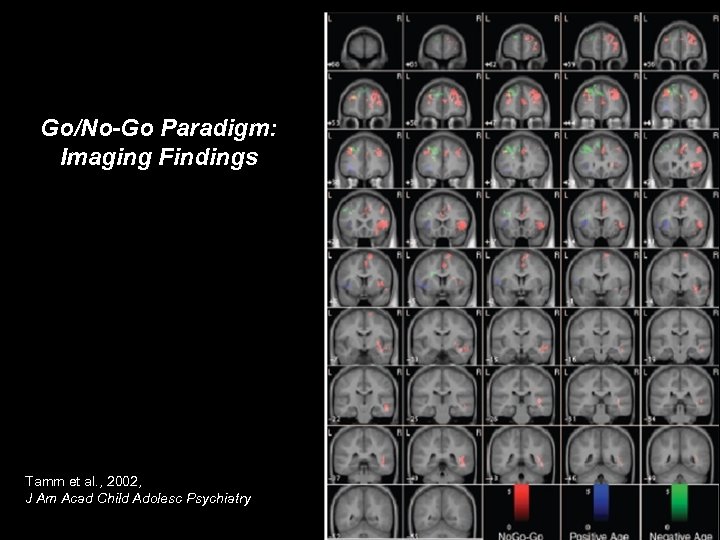 Go/No-Go Paradigm: Imaging Findings Tamm et al. , 2002, J Am Acad Child Adolesc
