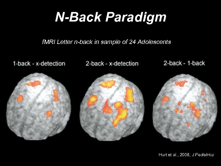 N-Back Paradigm f. MRI Letter n-back in sample of 24 Adolescents Hurt et al.