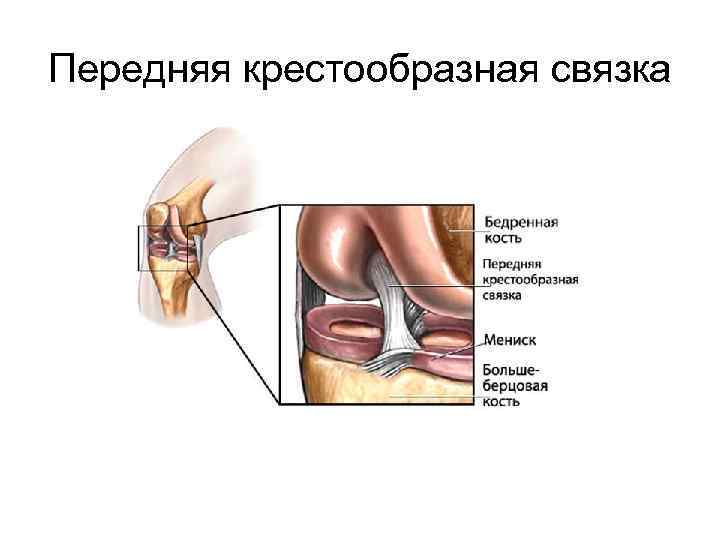 Передняя крестообразная связка 