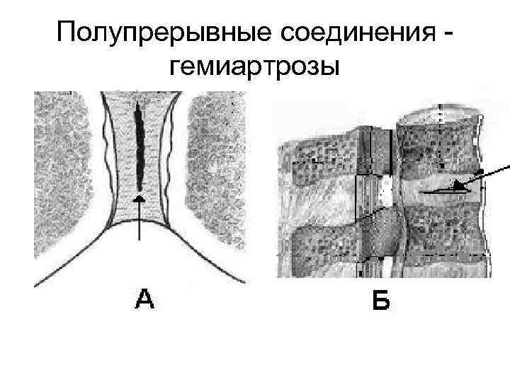 Полупрерывные соединения гемиартрозы 