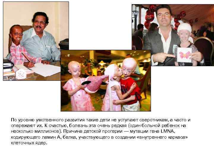 По уровню умственного развития такие дети не уступают сверстникам, а часто и опережают их.