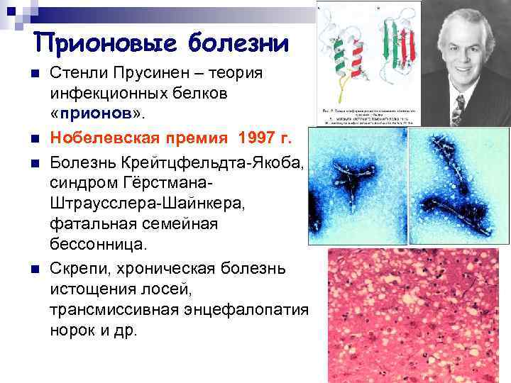 Прионовые болезни n n Стенли Прусинен – теория инфекционных белков «прионов» . Нобелевская премия