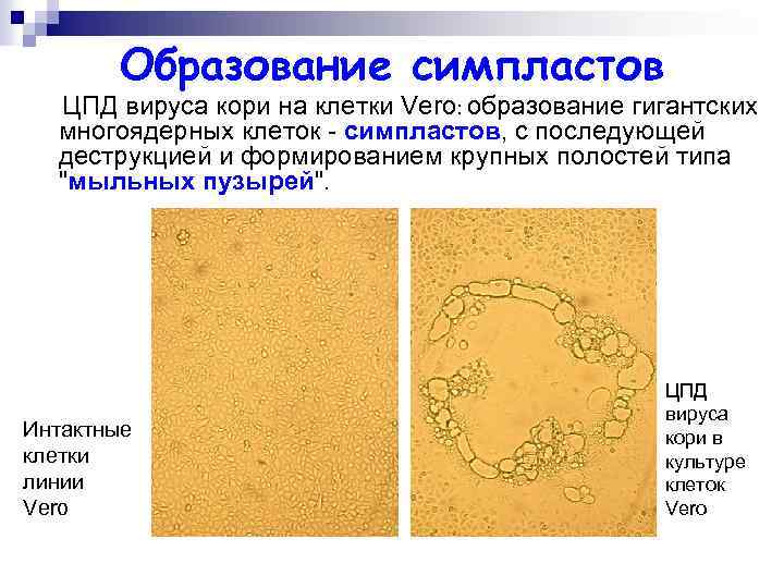 Образование симпластов ЦПД вируса кори на клетки Vero: образование гигантских многоядерных клеток - симпластов,