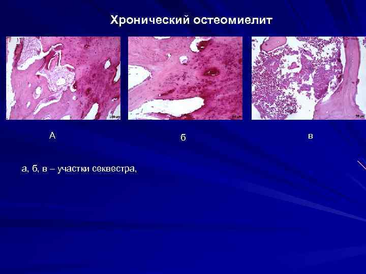 Радикулярная киста презентация