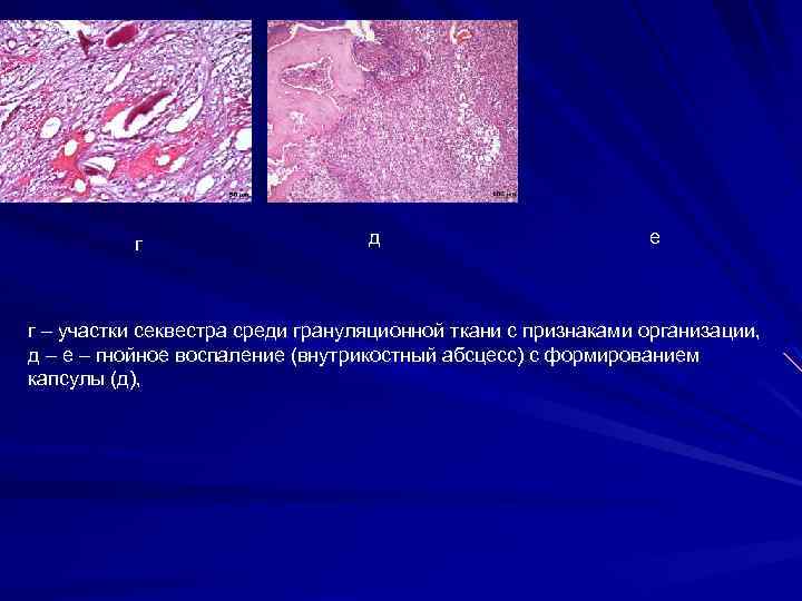 Радикулярная киста презентация