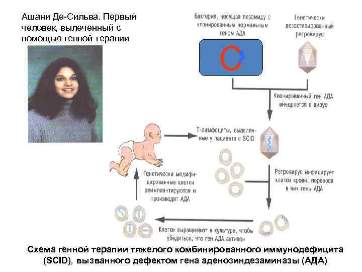 Ашани Де-Сильва. Первый человек, вылеченный с помощью генной терапии C Схема генной терапии тяжелого