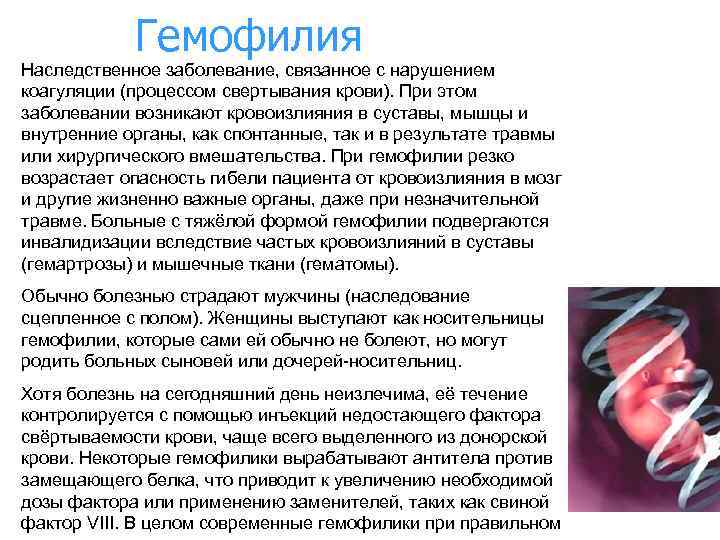 Гемофилия Наследственное заболевание, связанное с нарушением коагуляции (процессом свертывания крови). При этом заболевании возникают