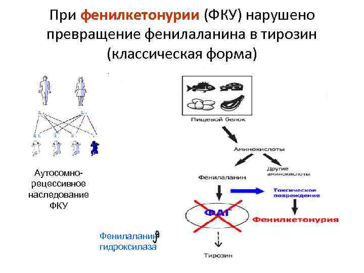 При фенилкетонурии (ФКУ) нарушено превращение фенилаланина в тирозин (классическая форма) Аутосомнорецессивное наследование ФКУ Фенилаланин