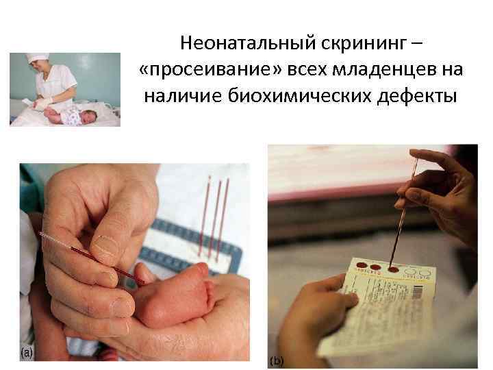 Неонатальный скрининг – «просеивание» всех младенцев на наличие биохимических дефекты 
