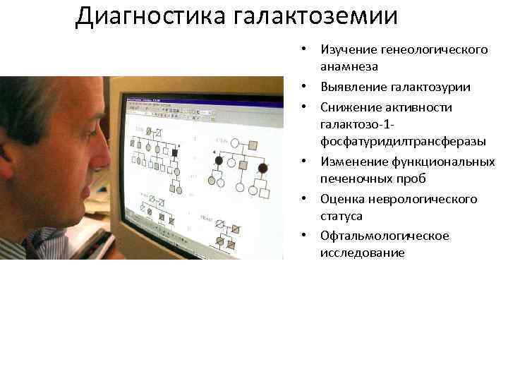 Диагностика галактоземии • Изучение генеологического анамнеза • Выявление галактозурии • Снижение активности галактозо-1 фосфатуридилтрансферазы
