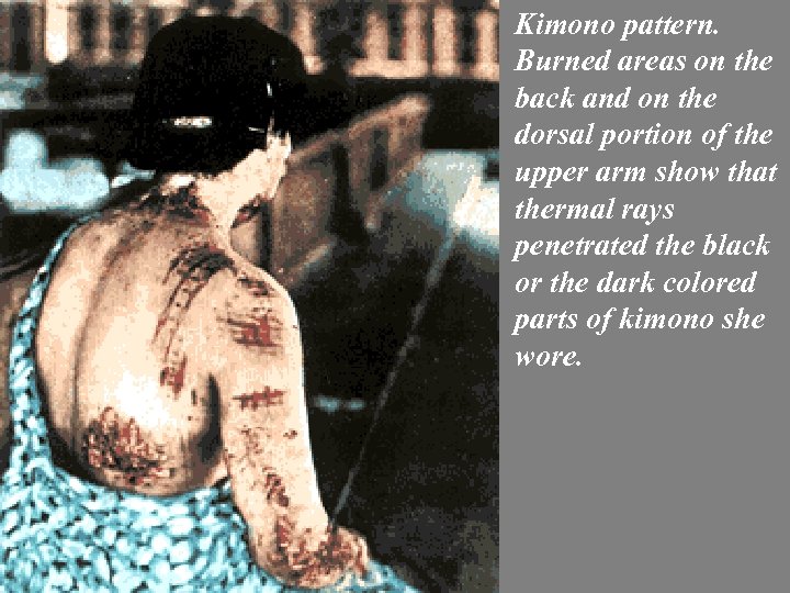 Kimono pattern. Burned areas on the back and on the dorsal portion of the