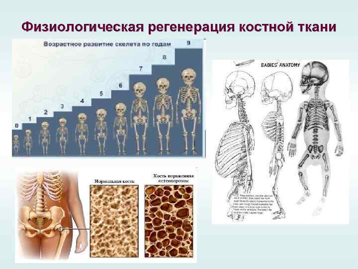 Физиологическая регенерация костной ткани 