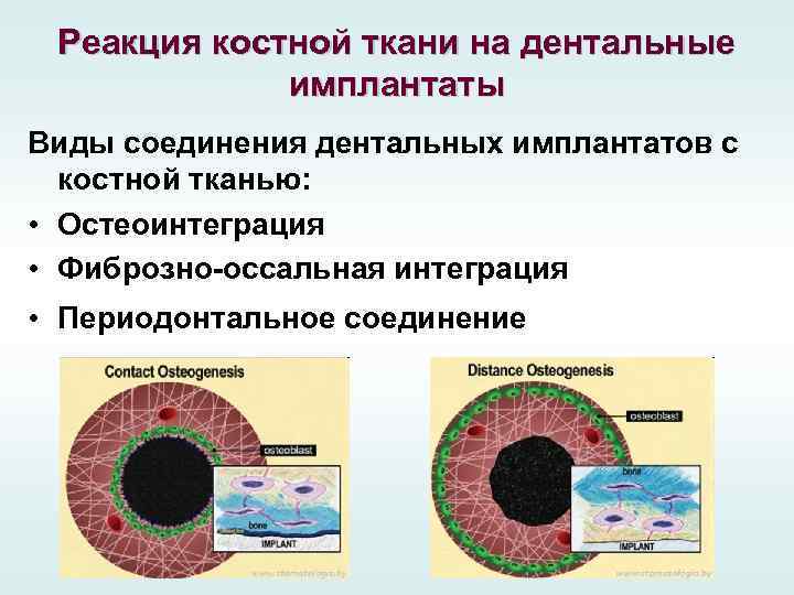 Реакция костной ткани на дентальные имплантаты Виды соединения дентальных имплантатов с костной тканью: •