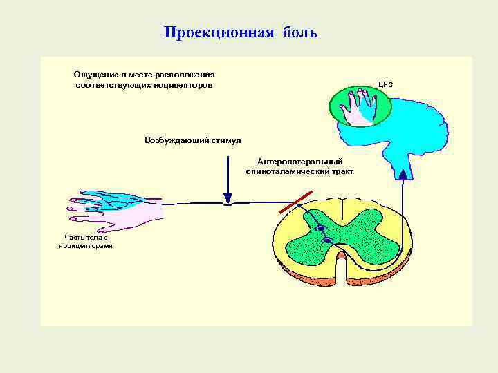 Проекционная боль Ощущение в месте расположения соответствующих ноцицепторов ЦНС Возбуждающий стимул Антеролатеральный спиноталамический тракт