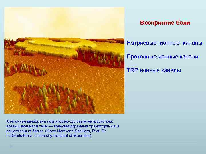 Восприятие боли Натриевые ионные каналы Протонные ионные канали TRP ионные каналы Клеточная мембрана под