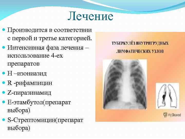 Лечение Производится в соответствии с первой и третье категорией. Интенсивная фаза лечения – использование