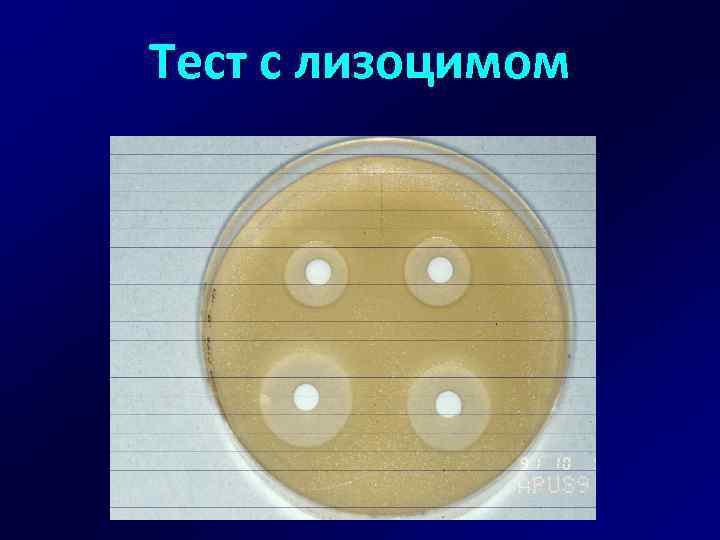 Тест с лизоцимом 