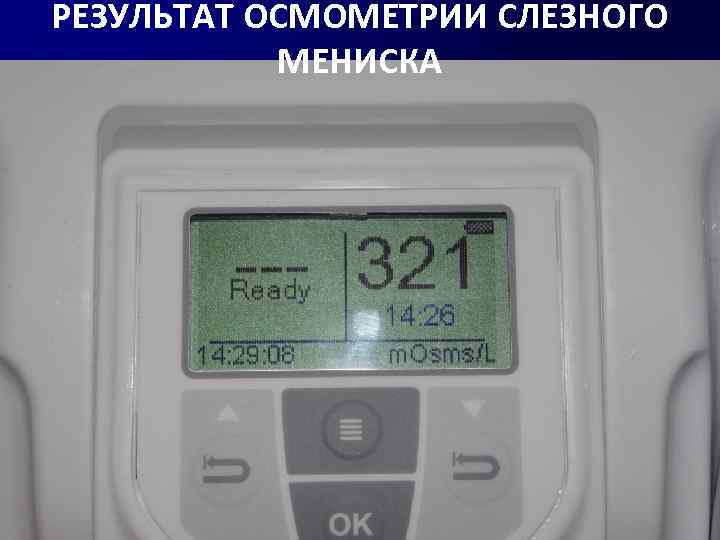 РЕЗУЛЬТАТ ОСМОМЕТРИИ СЛЕЗНОГО МЕНИСКА 