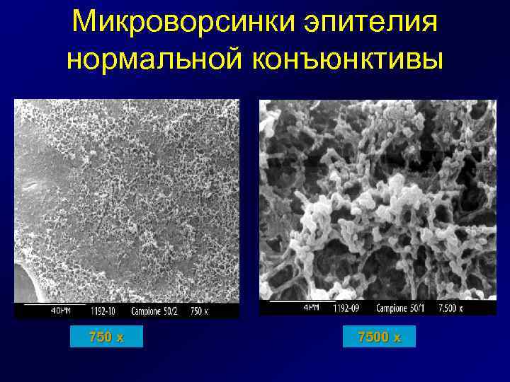 Микроворсинки эпителия нормальной конъюнктивы 750 x 7500 x 