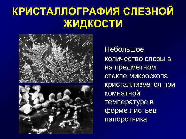 КРИСТАЛЛОГРАФИЯ СЛЕЗНОЙ ЖИДКОСТИ Небольшое количество слезы в на предметном стекле микроскопа кристаллизуется при комнатной