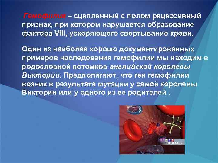 Гемофилия – сцепленный с полом рецессивный признак, при котором нарушается образование фактора VIII, ускоряющего