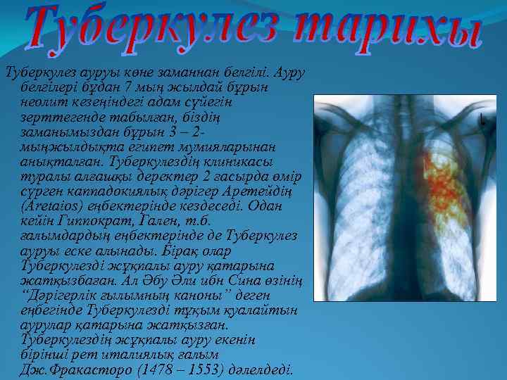 Туберкулез ауруы көне заманнан белгілі. Ауру белгілері бұдан 7 мың жылдай бұрын неолит кезеңіндегі