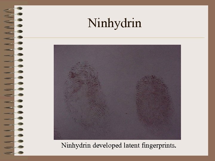 Ninhydrin developed latent fingerprints. 