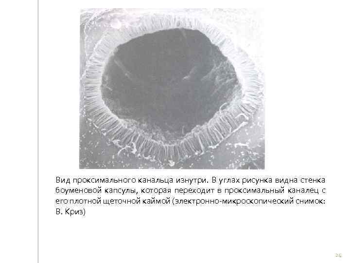 Вид проксимального канальца изнутри. В углах рисунка видна стенка боуменовой капсулы, которая переходит в