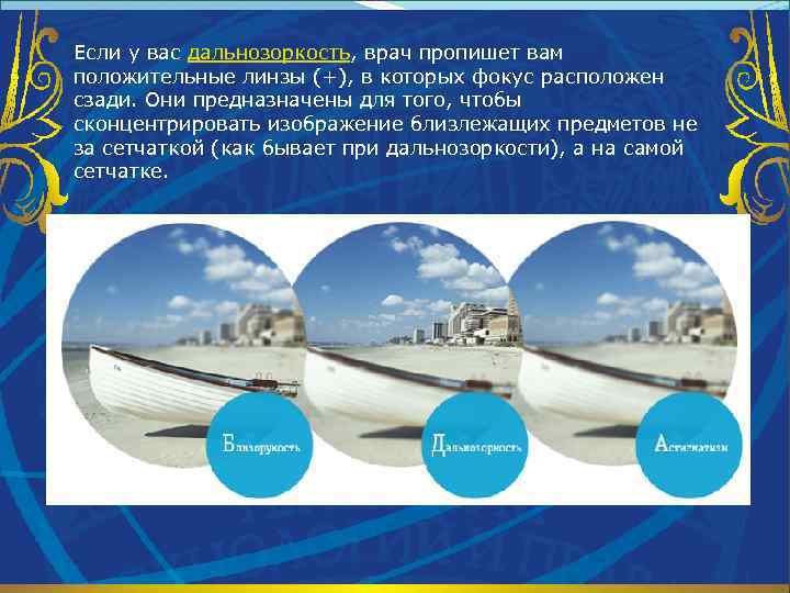 Если у вас дальнозоркость, врач пропишет вам положительные линзы (+), в которых фокус расположен