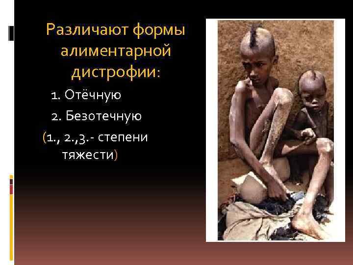 Различают формы алиментарной дистрофии: 1. Отёчную 2. Безотечную (1. , 2. , 3. степени