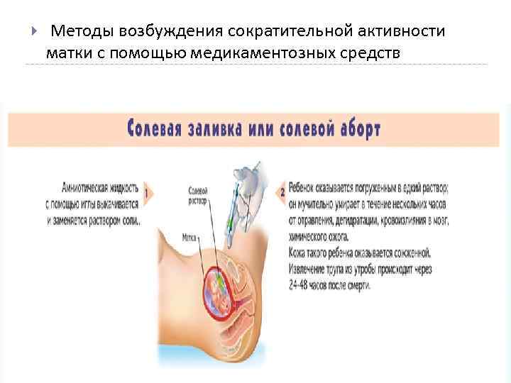  Методы возбуждения сократительной активности матки с помощью медикаментозных средств 