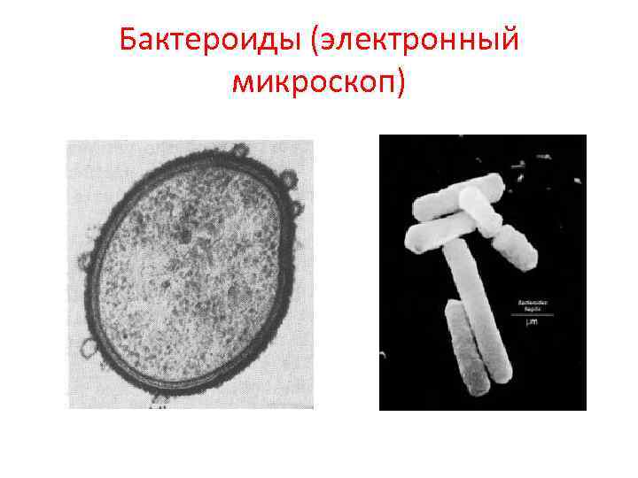 Бактероиды (электронный микроскоп) 