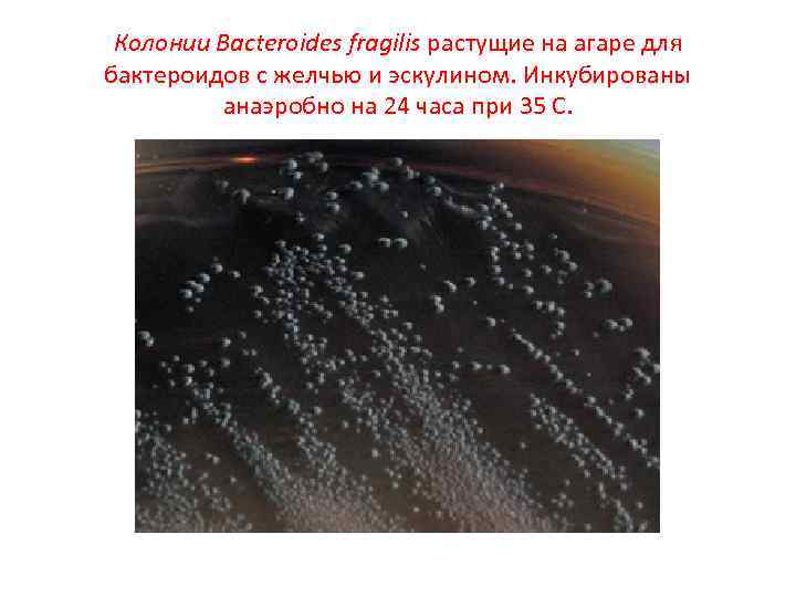 Колонии Bacteroides fragilis растущие на агаре для бактероидов с желчью и эскулином. Инкубированы анаэробно