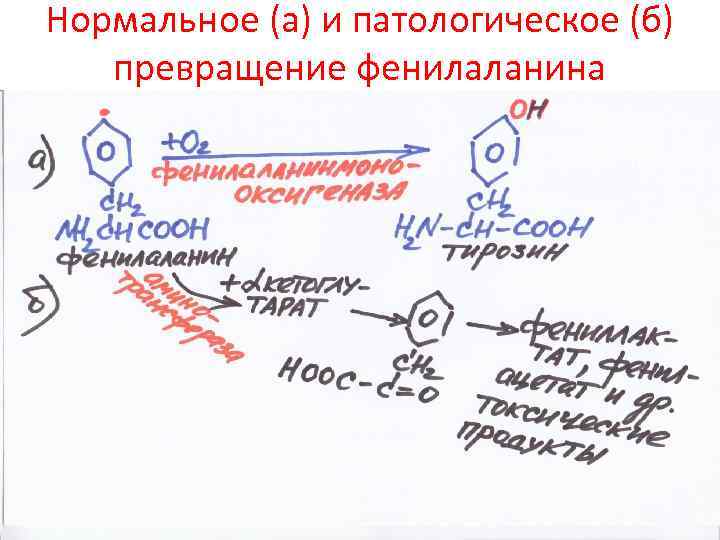 Нормальное (а) и патологическое (б) превращение фенилаланина 