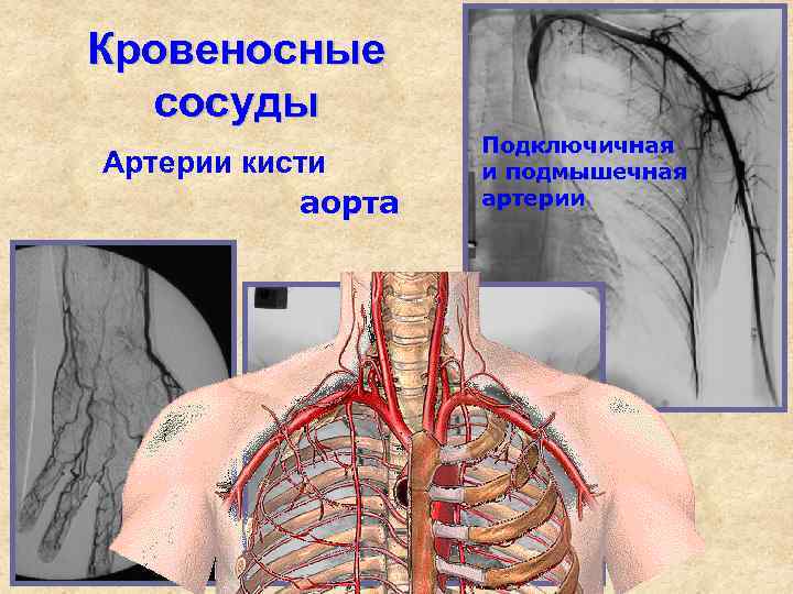 Щитошейный ствол подключичной артерии. Анатомия человека подключичная артерия. Подключичная артерия, (а. subclavia),. Подключичный тромбоз