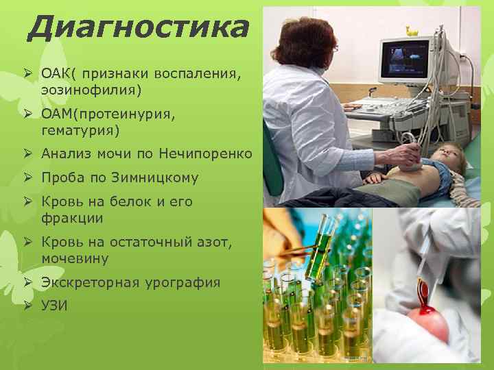 Диагностика Ø ОАК( признаки воспаления, эозинофилия) Ø ОАМ(протеинурия, гематурия) Ø Анализ мочи по Нечипоренко