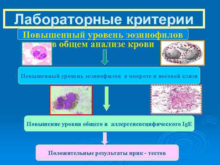 Лабораторные критерии Повышенный уровень эозинофилов в общем анализе крови Повышенный уровень эозинофилов в мокроте