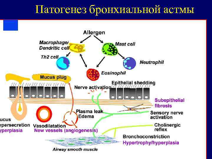 Схема патогенеза бронхиальной астмы