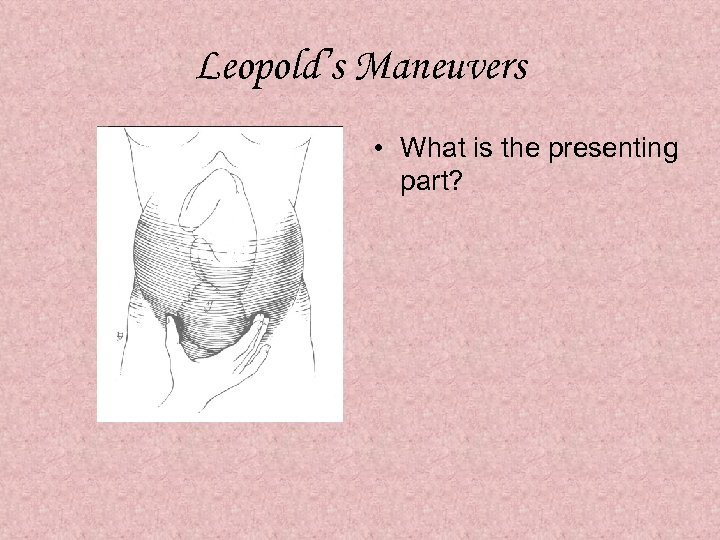 Leopold’s Maneuvers • What is the presenting part? 