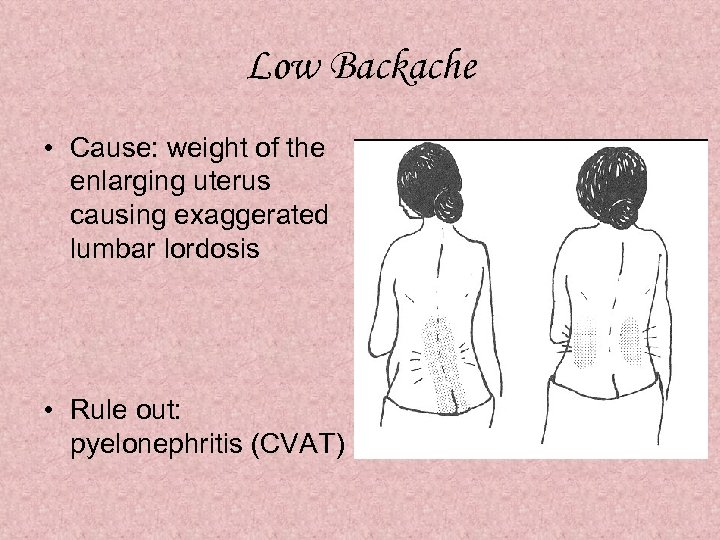 Low Backache • Cause: weight of the enlarging uterus causing exaggerated lumbar lordosis •